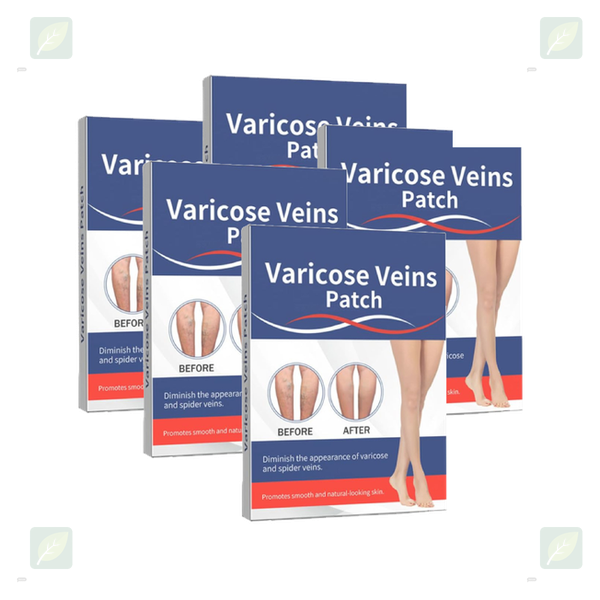Varicose